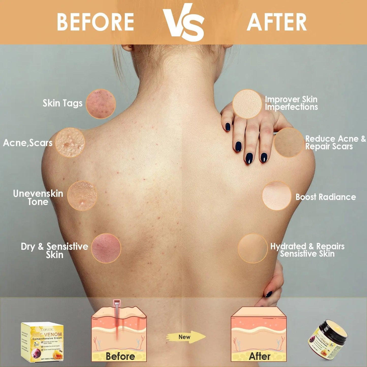 Body Cream BEE VENOM Kosmev